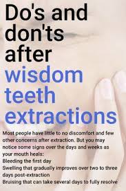 During this time, you may have: 900 Dental Tips And Tricks Ideas In 2021 Dental Dental Facts Dentistry