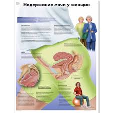 Female Urinary Incontinence Chart