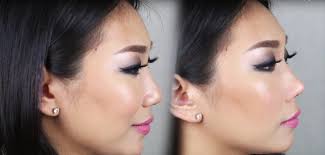 Maybe you would like to learn more about one of these? Doctors Are Warning Against Machine That Claims To Give Instant Nose Job In 30 Seconds