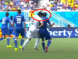 Luis suarez biss, natal / vienna. Hier Sind Alle Drei Vorfalle Bei Denen Luis Suarez Seine Gegner Gebissen Hat Business Insider
