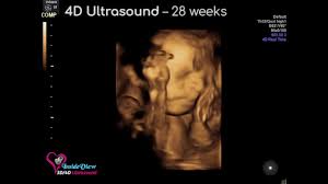 Maybe you would like to learn more about one of these? 3d 4d Ultrasounds Near Olympia Wa Inside View 3d 4d Ultrasound