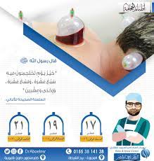 سوف نتحدث في هذا المقال عن مواضع الحجامة لمرض دوالي الخصية من خلال موقع فكرة في الآونة الأخيرة، أصبح مرض الدوالي. Ø§Ù„Ø­Ø¬Ø§Ù…Ø© Graphic Design Advertising Graphic Design