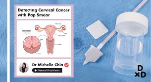 Apa itu pap smear ? Pap Smear Di Singapura Panduan Utama Deteksi Kanker Serviks 2020