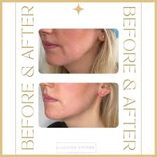 Dr Louise Pierre Aesthetics in East Sussex