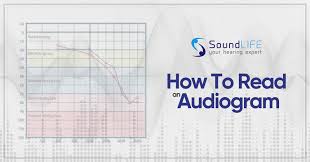 It tells us the type and degree of hearing loss. How To Read An Audiogram