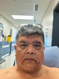 I'm emergency attacked by two pit bull dogs. Bad pain in my arms. Lucky I  had cell phone