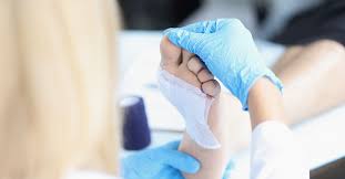 Image result for Alginate Dressing
