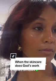 Profihlo come through 💕 #profhilo #profhilotreatment #skin #glasssskin  #fyp #major