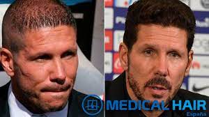 Simeone también quiso de esta forma diferenciar este triunfo del conseguido en el año 2014. Injerto Capilar Cholo Simeone Donde Y Como Se Hizo El Trasplante De Pelo
