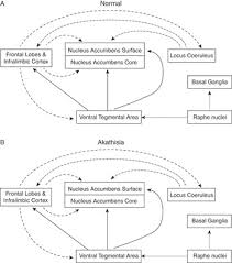 Image result for Akathisia