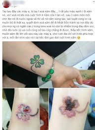 Những ảnh này thường làm người ta buồn hơn. Xoa Hinh XÄƒm Ä'á»ƒ Quen Tinh CÅ© Sau Khi Bá»‹ Pháº£n Bá»™i Co Gai Bá»‹ Nhiá»…m Trung Hoáº¡i Tá»­ Da Ä'au Ä'á»›n