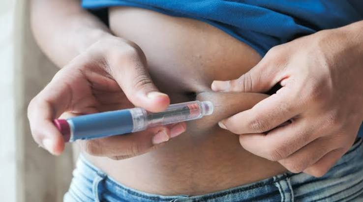Caneta para emagrecer: tipos, resultados, riscos e quando vale a pena usar - Clínica Bellit