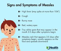 Image result for measles