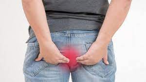 Cara Mengobati Sakit Wasir Atau Sakit Ambeien Di Rumah Lakukan Ini 3 Kali Sehari Tribunnews Bogor