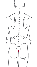 Steissbeinschmerzen Durch Fruhere Sturze
