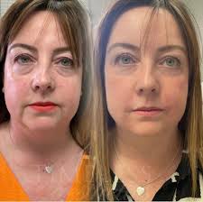 Paula brookes- Timeless Aesthetics ®️ (@paula_timelessaesthetics) · Rugby