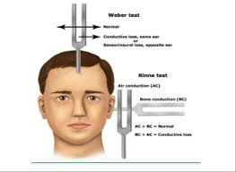 Q 2__________ Usmle Forum