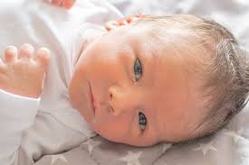 Bayi yang baru lahir akan melalui ujian yang disebut sebagai neonatal screening. Penyakit Kuning Pada Bayi Penyebab Gejala Dan Pengobatan