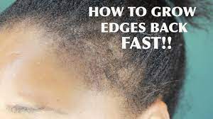 How To Grow Your Edges Back In 2 Weeks Grow Edges Thick Hair Styles Regrow Hair