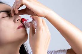 Situasi hidung berdarah disebabkan pelbagai faktor, malah langkah awal dengan melakukan ini bermanfaat dijadikan panduan buat mak ayah dalam mengetahui punca hidung anak berdarah. Tak Perlu Panik Kenali Penyebab Ingus Berdarah Dan Cara Mengatasinya Alodokter