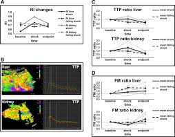 Sonographic Real Time Imaging Of Tissue Perfusion In A