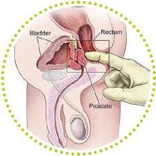 Prostate massage can have benefits, including treatment and prevention of prostatitis and erectile dysfunction, as well as improved urine flow. 10 Prostate Massage Therapy Ideas Prostate Massage Prostate Massage Therapy