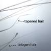 Feel free to discuss hair loss remedies, technologies, transplants, living with hair loss, cosmetic concealments. Https Encrypted Tbn0 Gstatic Com Images Q Tbn And9gcqi9jaedqstmeb5imw3f3bvtrivnkotknfkjl2ibccukvptsqzt Usqp Cau