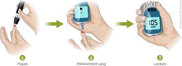 Surveiller sa glycémie - contrôler l'hyperglycémie et éviter l'hypoglycémie