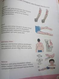 Maybe you would like to learn more about one of these? Lengkapilah Ciri Ciri Dan Penyebab Penyakit Atau Kelainan Otot Berikut Ayo Kerjakan Tugas Brainly Co Id