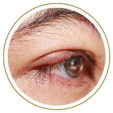 Image result for Blepharis sol