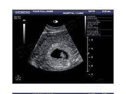 Pin On Fake Ultrasound