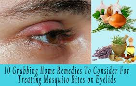 Mosquito Bite On Eyelid Treatment
