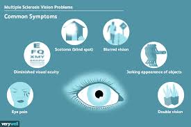 Vision Problems Caused By Ms