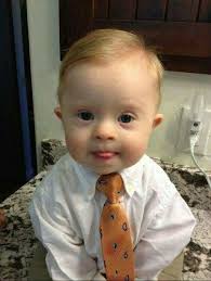 Pin By Florentina Toporan On ملائكه الارض Beautiful Children Down Syndrome Baby Cute Babies
