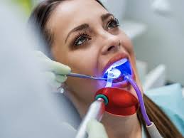 Laser Dental Cleaning