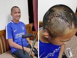 Darah perawan bulan madu movie. Remaja Aktif Sukan Selamat Jalani Pembedahan Ke 2 Buang Darah Beku Di Kepala Remaja