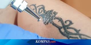 Check spelling or type a new query. Secara Medis Ada 3 Cara Hapus Tato Permanen Halaman All Kompas Com