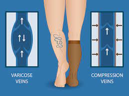 The Best Compression Stockings And Socks Of 2021 Reviewed And Tested