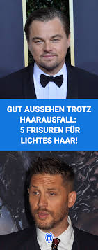 fur dunner werdendes lichtes haar und kahle stellen die 5 besten frisuren fur manner mit haarausfall ha haarausfall manner haar frisuren manner haarausfall