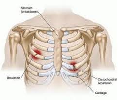 Pin On Exercises