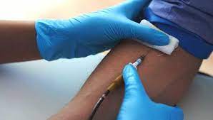 If your arm hurts or feels sore while giving blood please alert a member of staff. Donating Plasma What Are The Side Effects