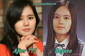 — han so hee's friend. Han Ga In Plastic Surgery Rumor Before And After Pictures