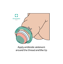 From start to finish, the entire procedure usually takes about 15 minutes or less. Newborns And Babies