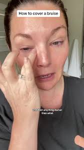 😱 how to cover a bruise or dark circles with makeup #mua #makeupartist  #colorcorection #colorcorrector #ultabeauty #makeuptutorial @ELF Cosmetics  💄✨