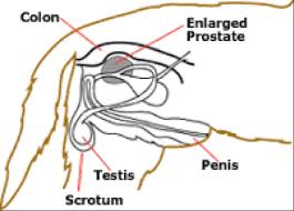 prostate cancer is cancer of the prostate.the prostate is a gland in the male reproductive system that surrounds the urethra just below the bladder. Crookwell Veterinary Hospital Animal Care Dogs Prostate Disease