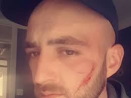 Horrified dad-of-one shows slash