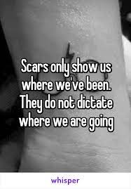 Scars Only Show Us Where We Ve Been They Do Not Dictate Where We Are Going
