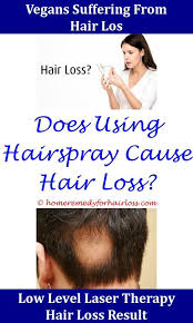 What Causes Male Hair Loss Hair Loss Soft Scalp Hair Loss Dog Hair Loss Hypothyroidism Main Reasons For Hair Loss Home Recipes For Ha Hypothyroidism Hair Loss Hair Loss Treatment Hair Loss