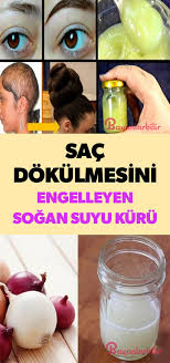 Sac Dokulmesine Sogan Suyu Sac Saglik Sogan
