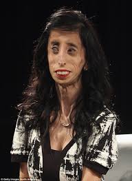 As of 2007, forbes magazine ranked her as the 38th most powerful woman in the world. World S Ugliest Woman Overcame Bullying God Reports